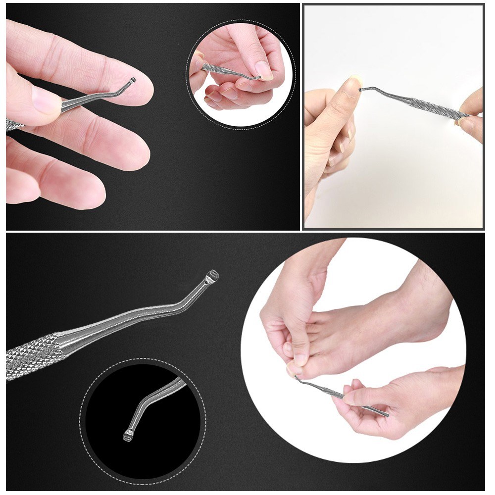 Ingrown Toenail Correction Kit Toenail Treatment Nail Glue Toenail Straightening Patch Pusher Lifter Recover Foot Correction Tool